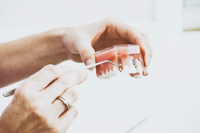 Implant zęba z tytanu czy cyrkonu