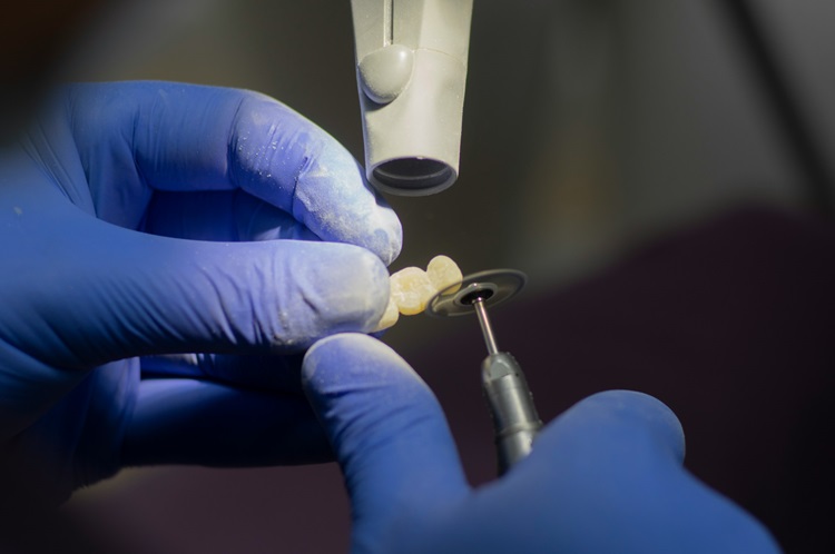Jakie zabiegi warto rozważyć przy okazji wstawiania implantów zębowych